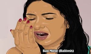 Bau Mulut(Halitosis)