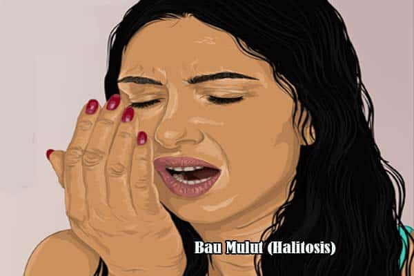 Bau Mulut(Halitosis)